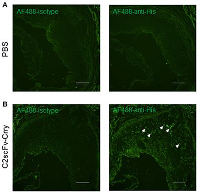 Complement Inhibition Targeted to Injury Specific Neoepitopes Attenuates Atherogenesis in Mice